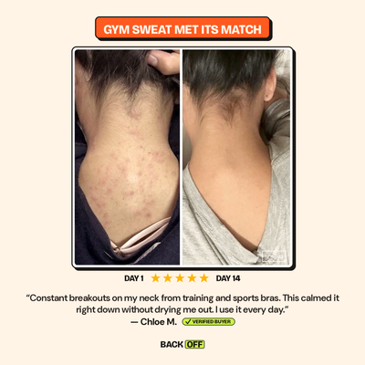 The Back Off Bar™ — Natural Soap for Back, Chest & Body Acne