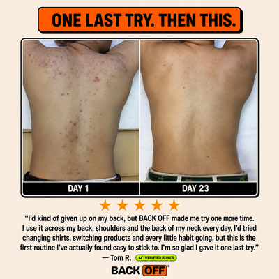 The Back Off Bar™ — Natural Soap for Back, Chest & Body Acne