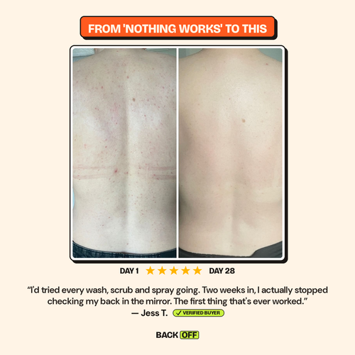 The Back Off Bar™ — Natural Soap for Back, Chest & Body Acne