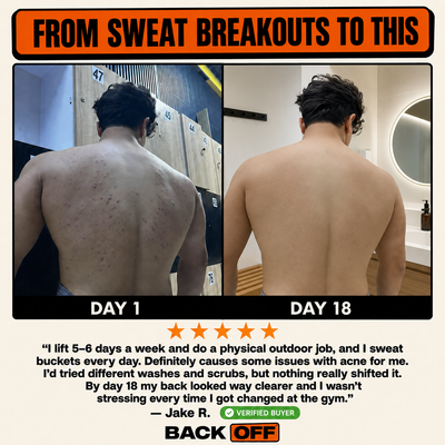 The Back Off Bar™ — Natural Soap for Back, Chest & Body Acne