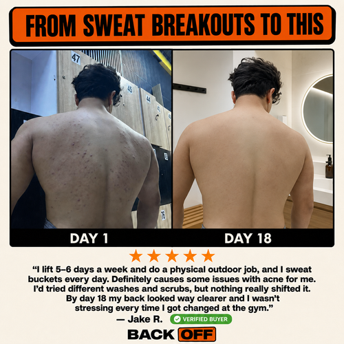 The Back Off Bar™ — Natural Soap for Back, Chest & Body Acne