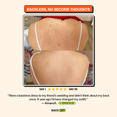 The Back Off Bar™ — Natural Soap for Back, Chest & Body Acne