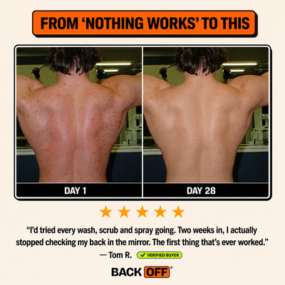 The Back Off Bar™ — Natural Soap for Back, Chest & Body Acne