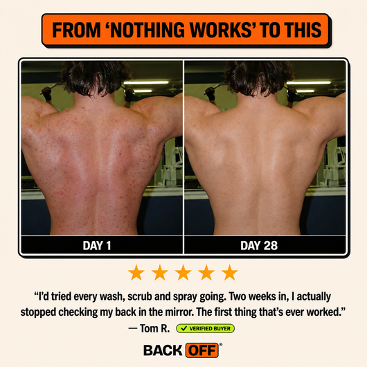 The Back Off Bar™ — Natural Soap for Back, Chest & Body Acne
