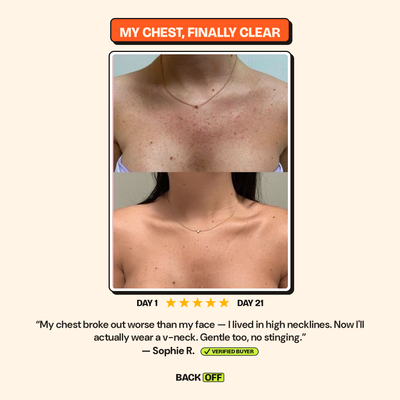 The Back Off Bar™ — Natural Soap for Back, Chest & Body Acne